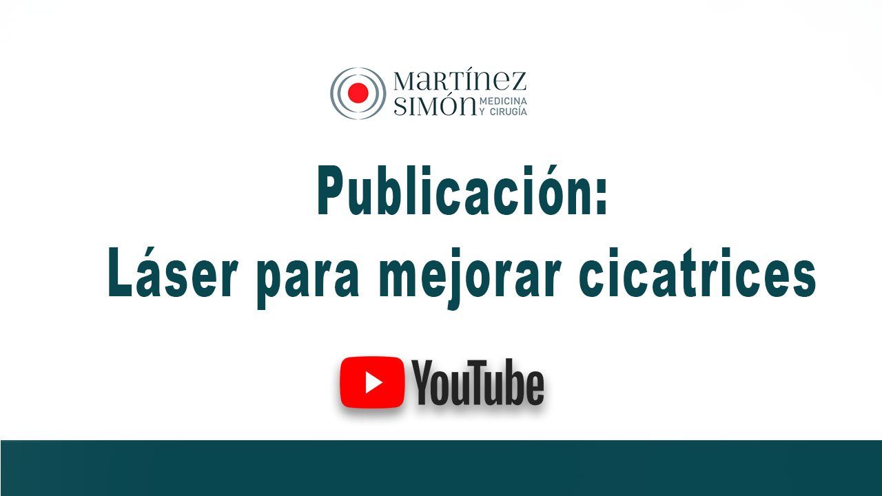 Laser para cicatrices laser para cicatrices
